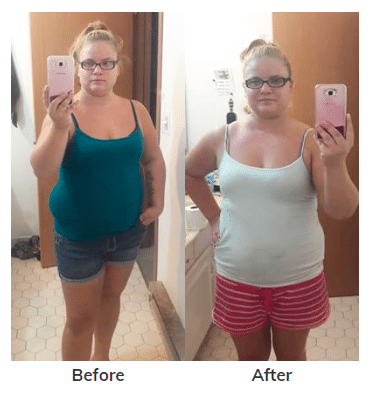 Stevie - before and after phentermine pictures